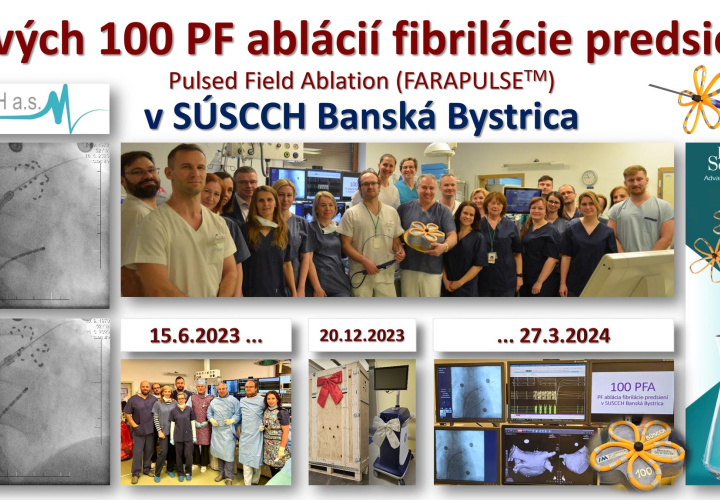 Prvých 100 (PULSED FIELD)